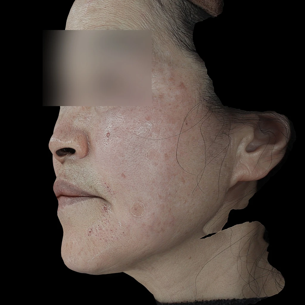 before_image