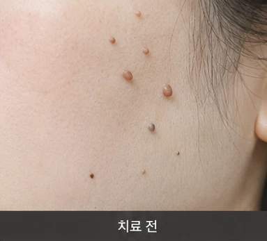 before_image