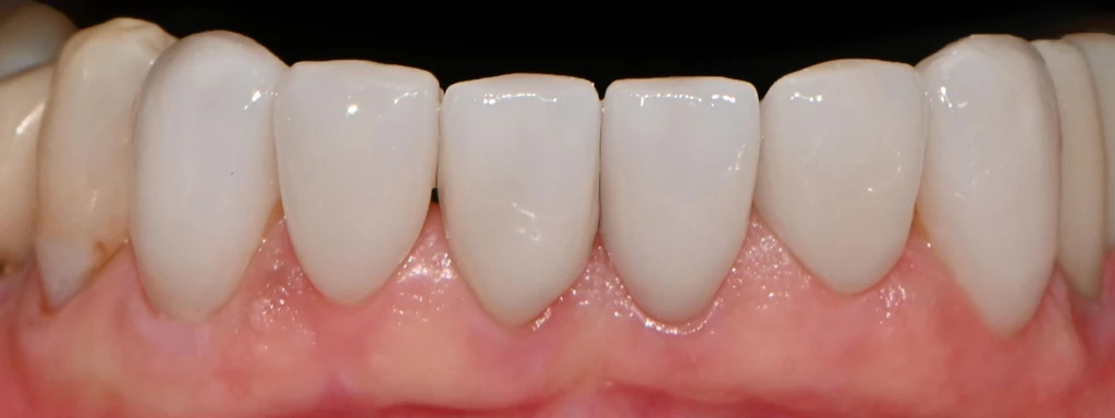 before_image
