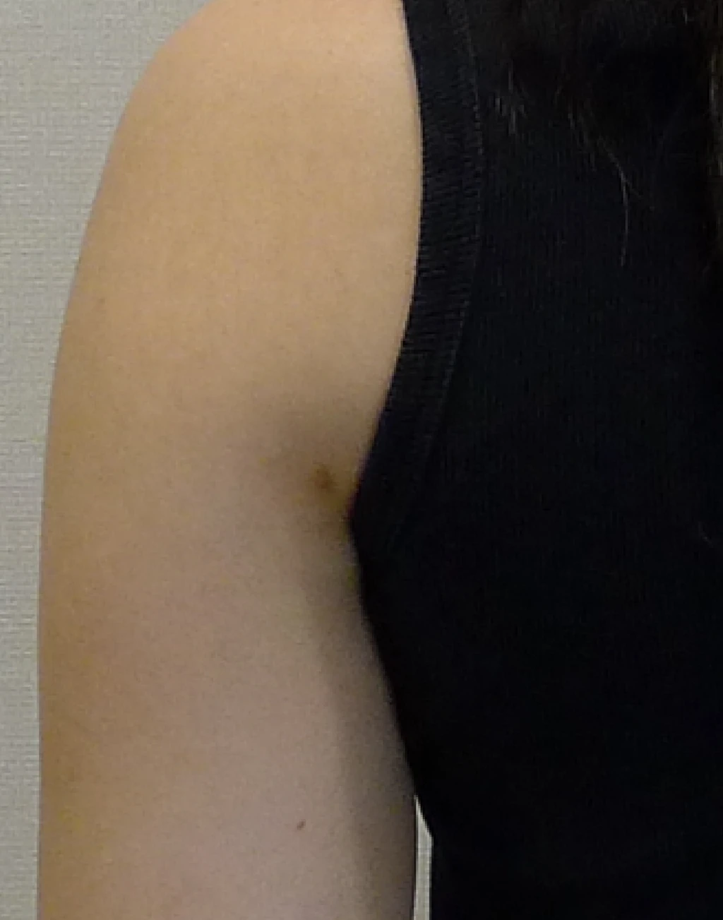 before_image