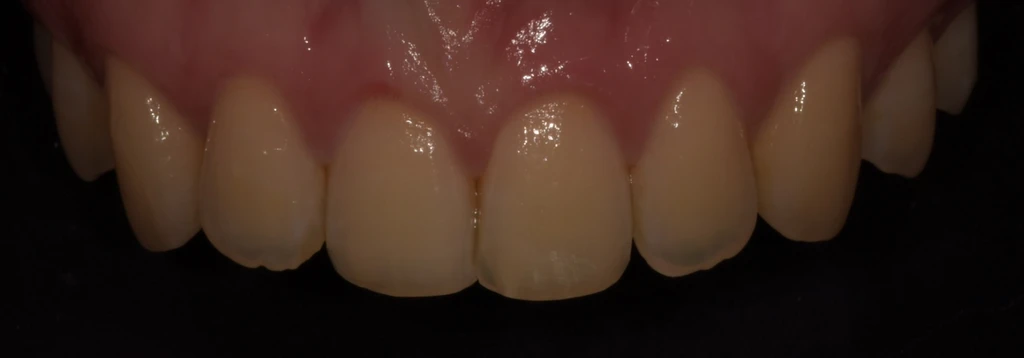 before_image