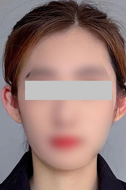 before_image
