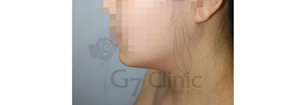 before_image
