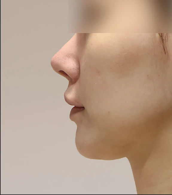 before_image