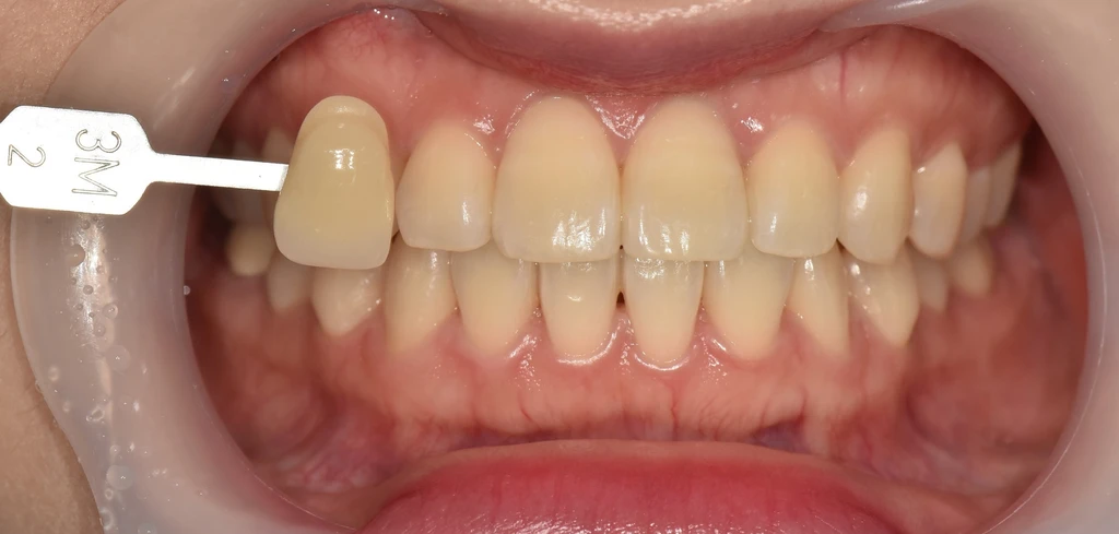 before_image