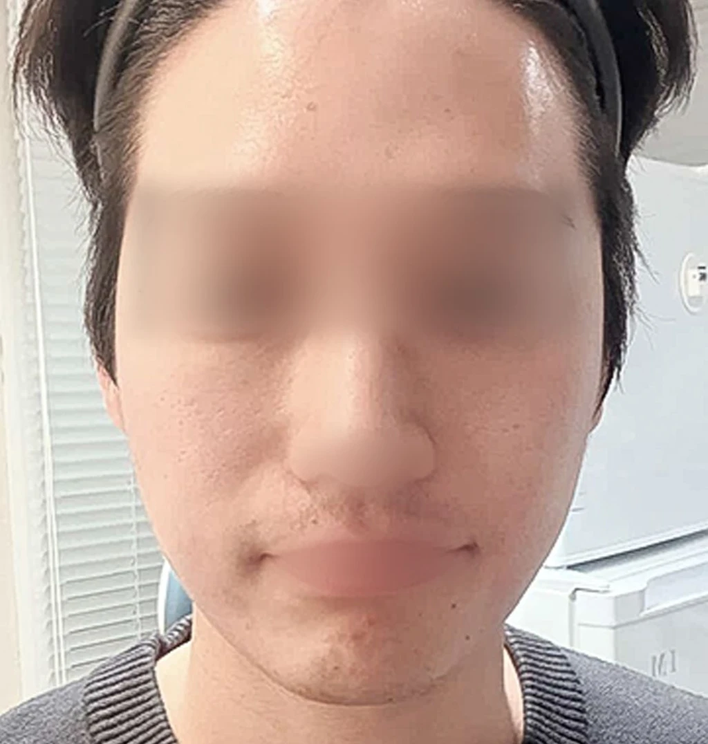 before_image