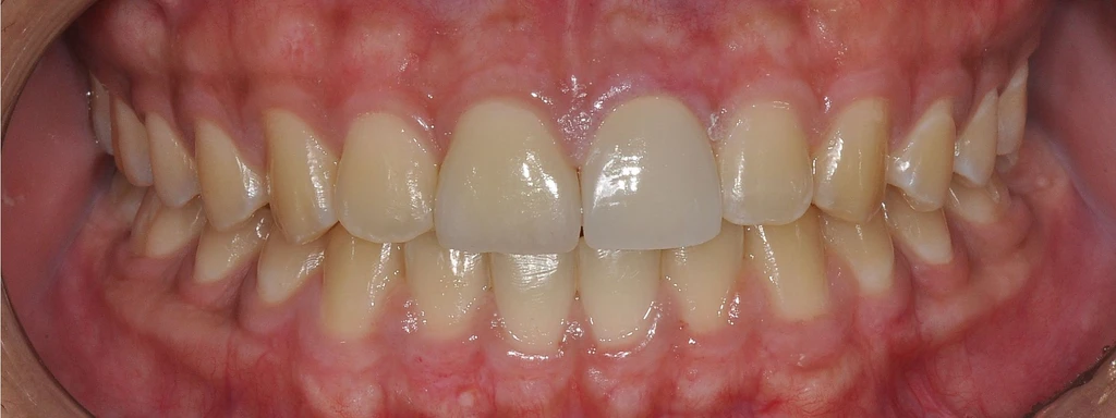 before_image