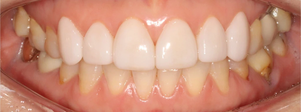before_image