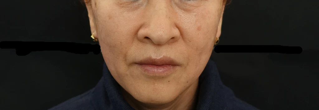 before_image
