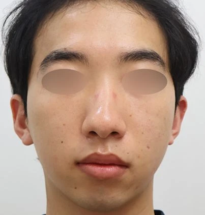 before_image