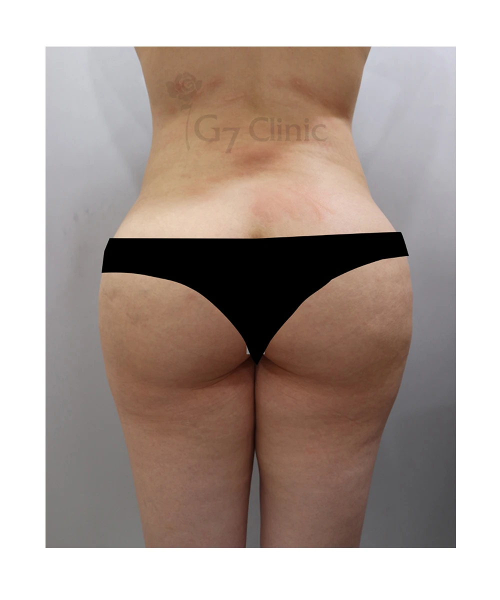before_image