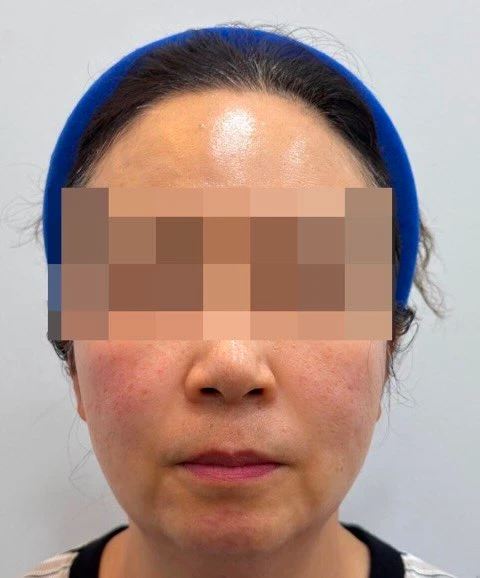 before_image