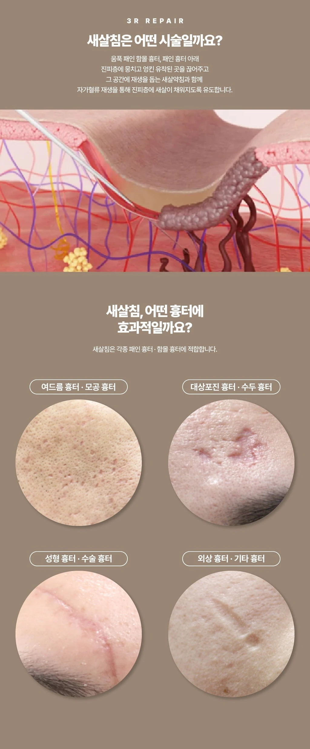 treatmentIntroduction