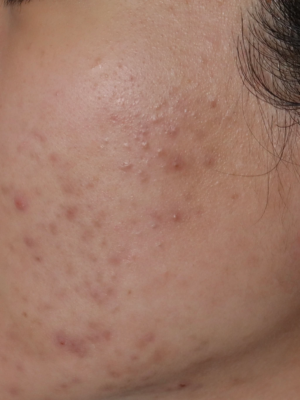 before_image