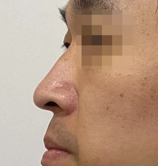 before_image