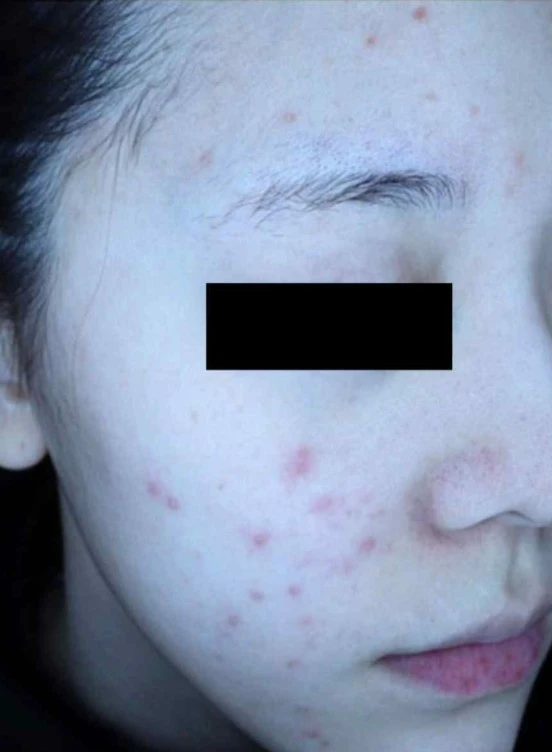 before_image