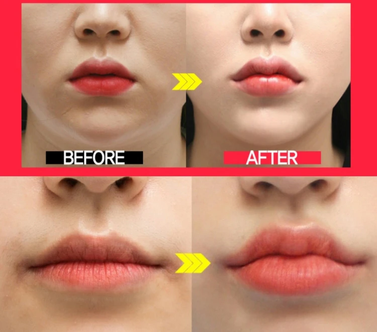 before_image