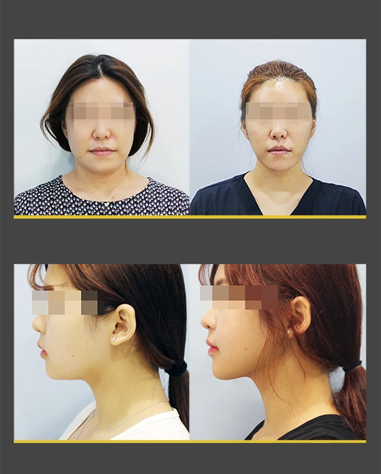 before_image