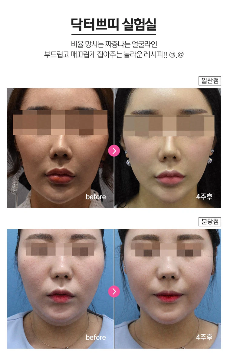 before_image