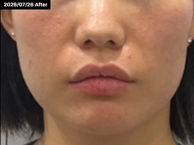 before_image