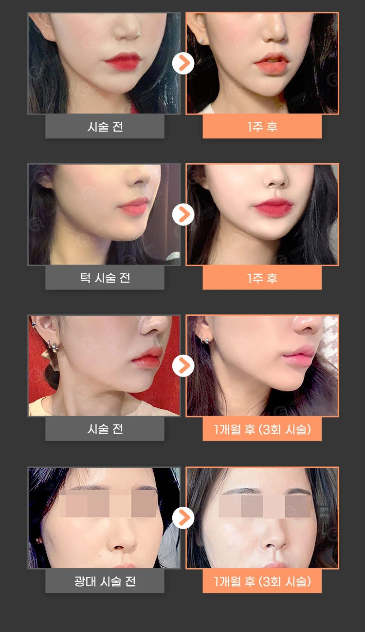 before_image