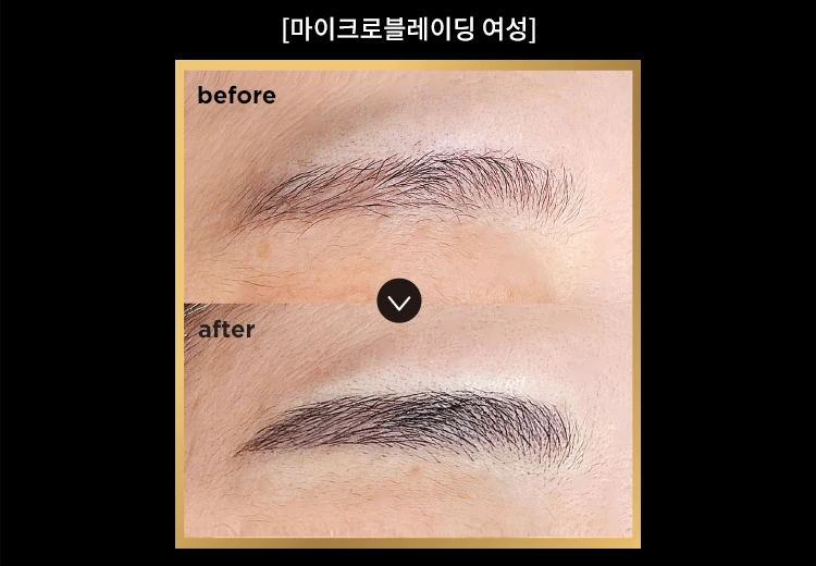 before_image