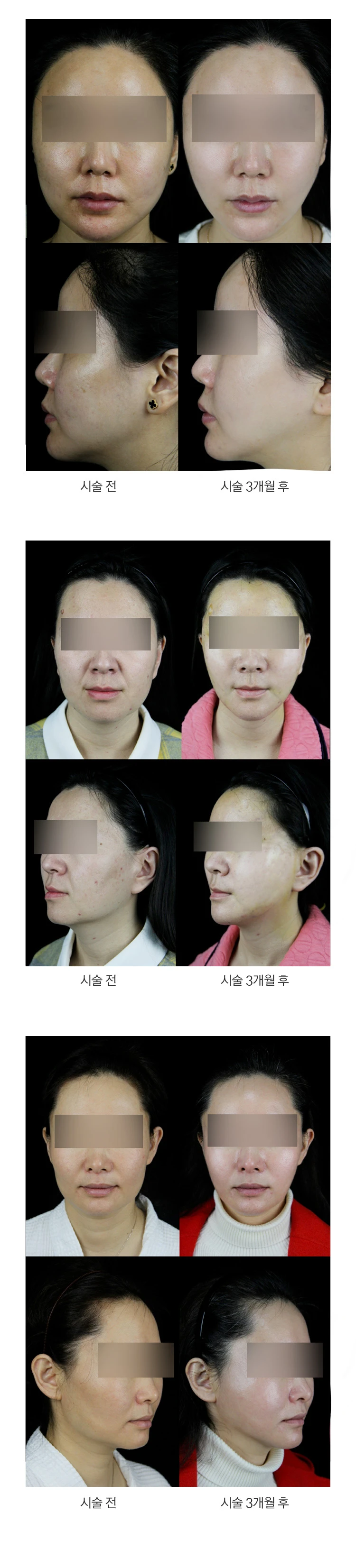 before_image