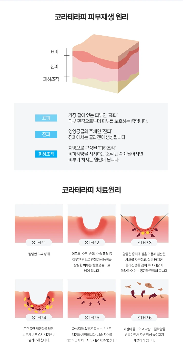 treatmentIntroduction
