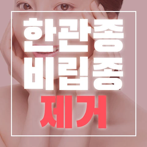 event thumbnail image