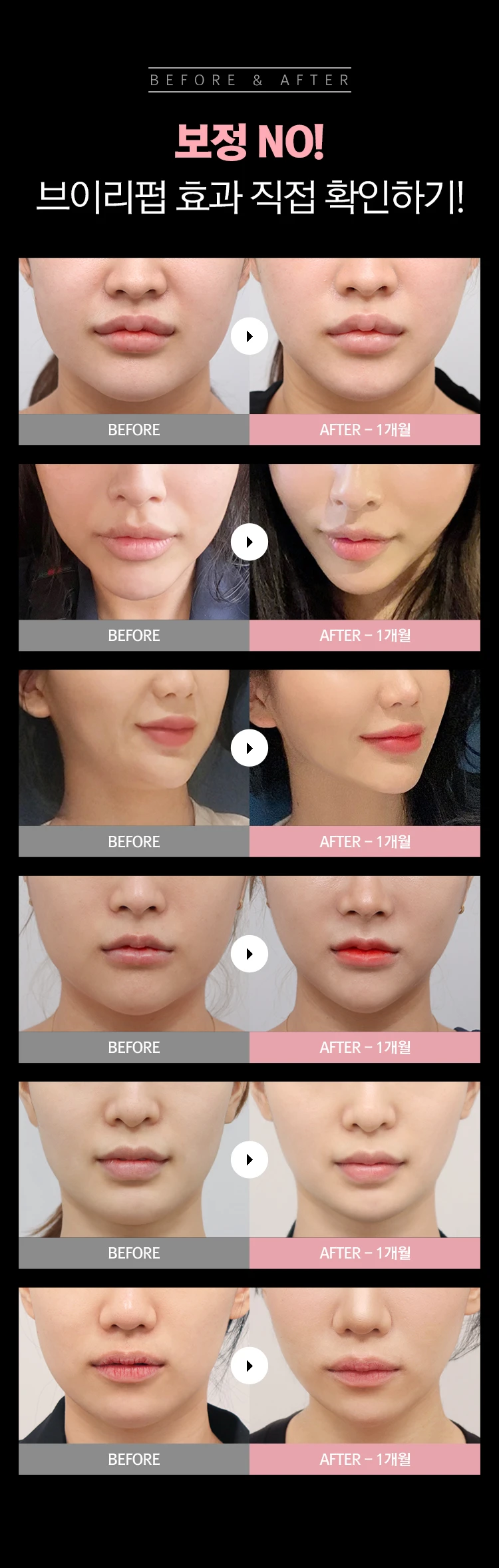 before_image