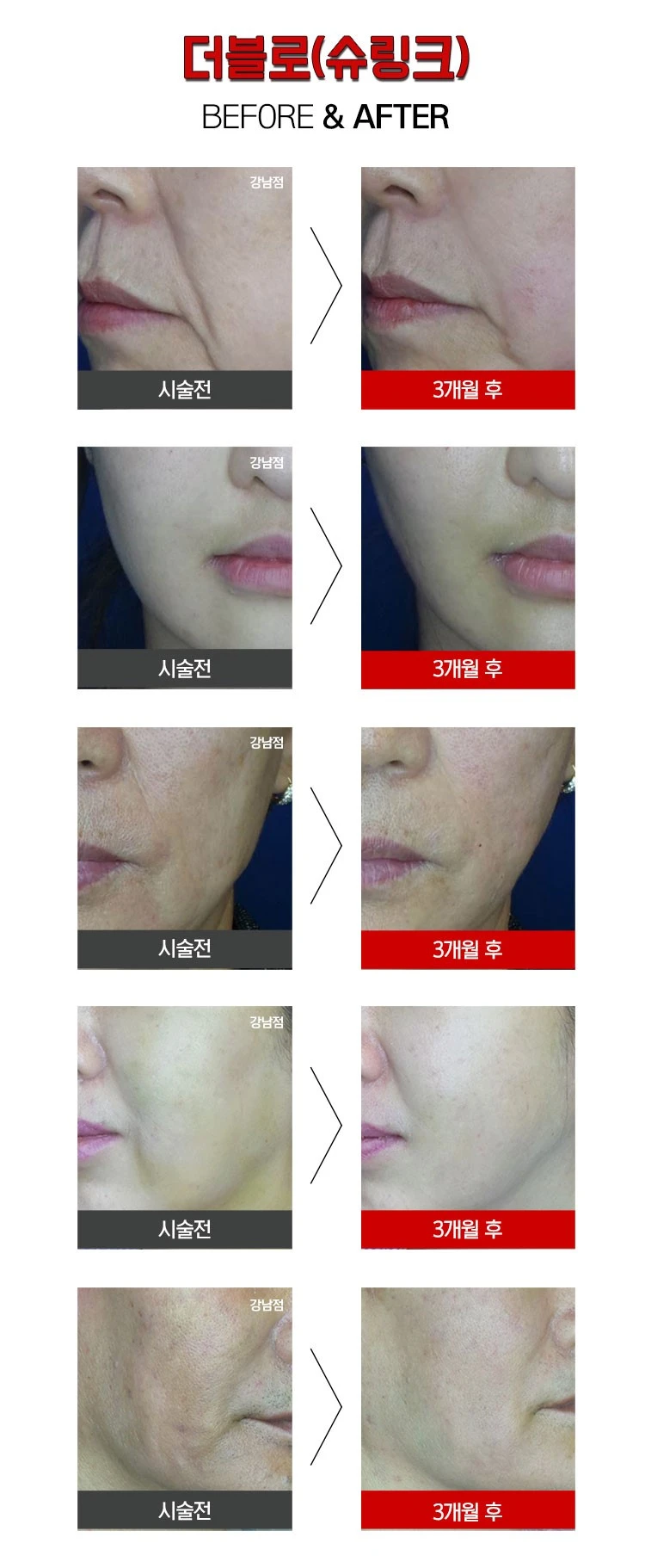 before_image