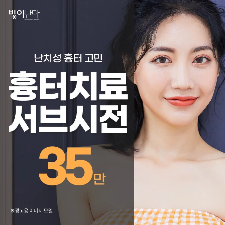 event thumbnail image