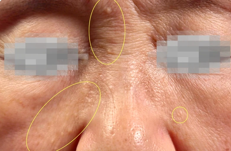 before_image