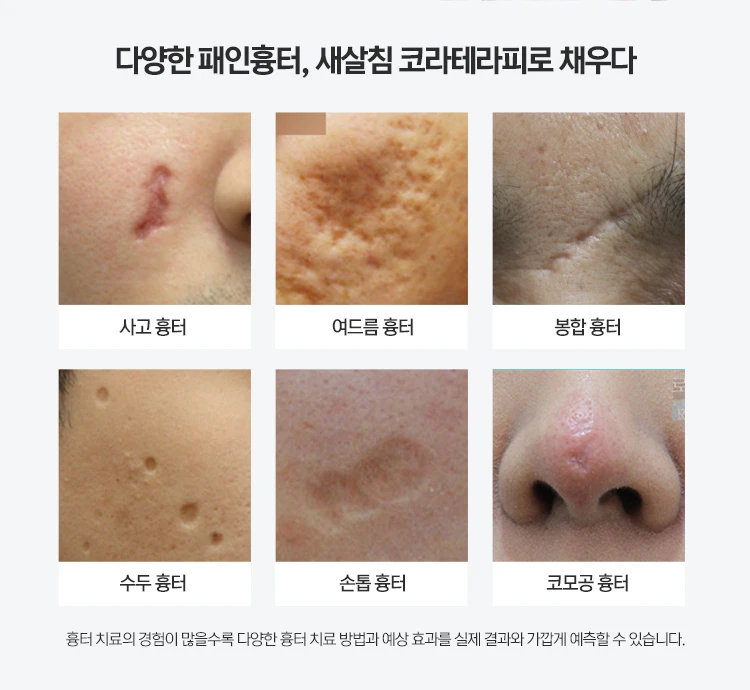 treatmentIntroduction