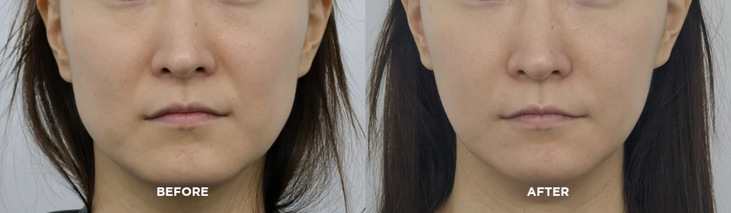 before_image