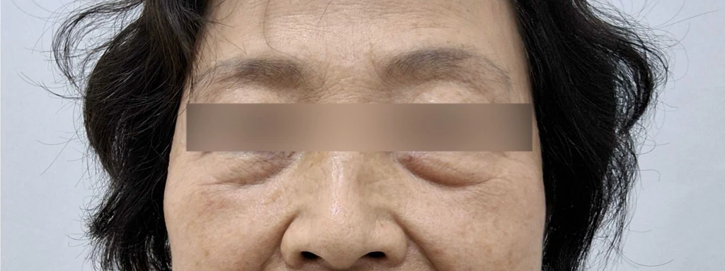 before_image