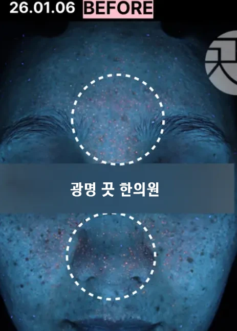 before_image