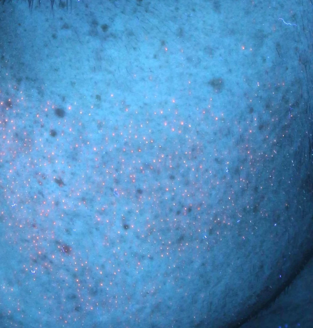 before_image