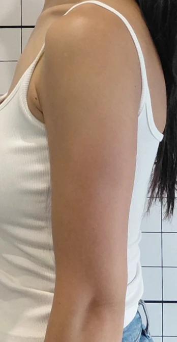before_image