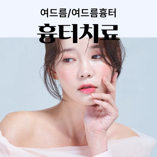 treatment-event-thumbnail