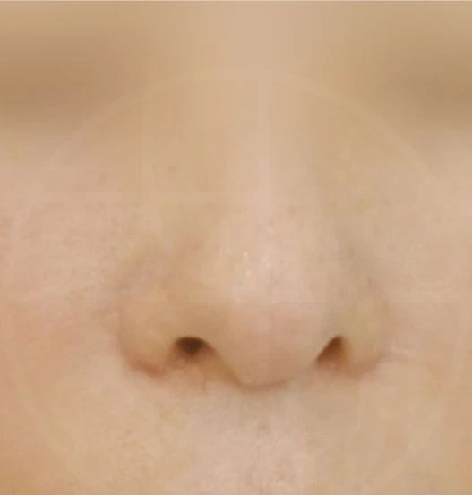 before_image