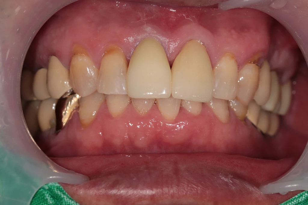 before_image