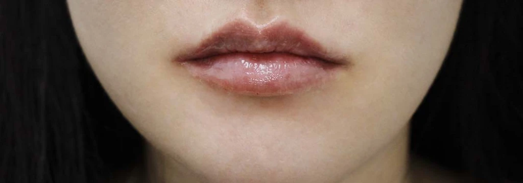 before_image