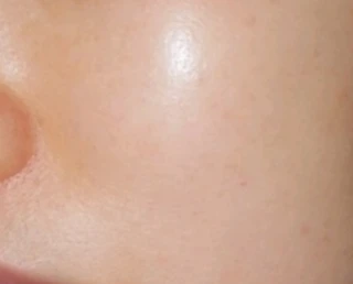 before_image