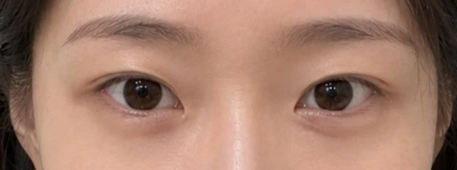 before_image