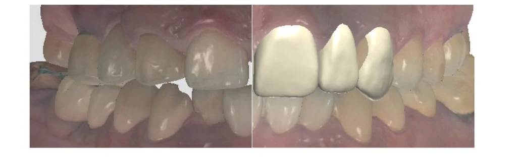 treatmentIntroduction