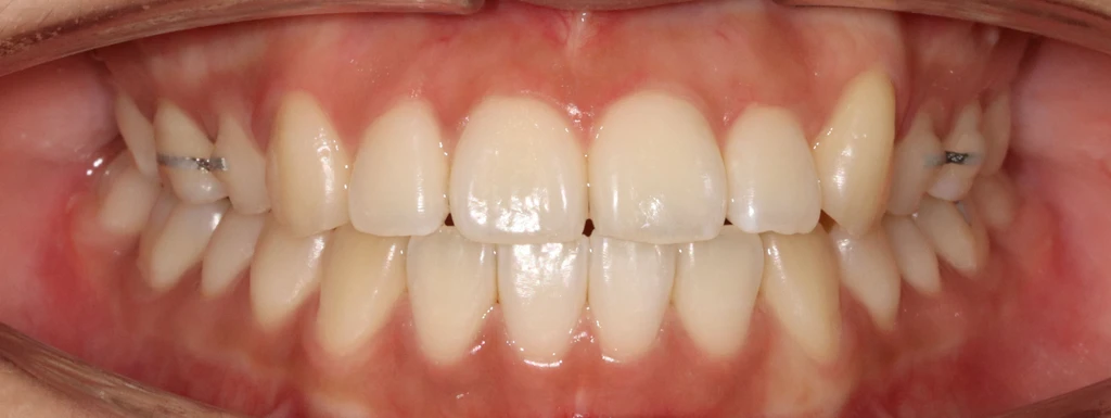 before_image