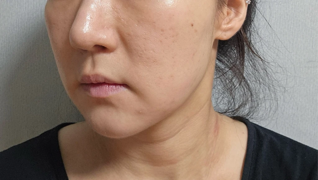 before_image