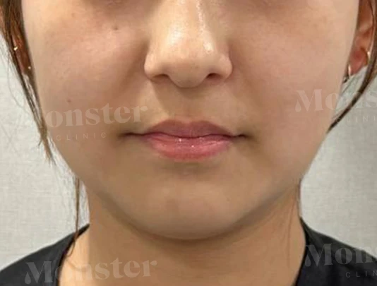 before_image