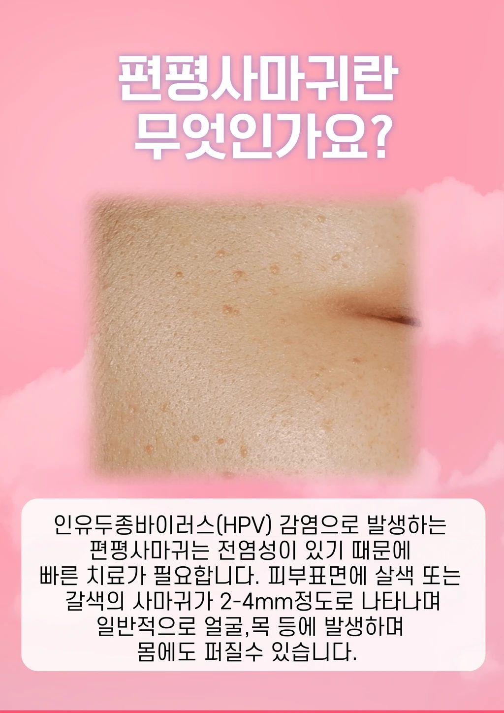 treatmentIntroduction